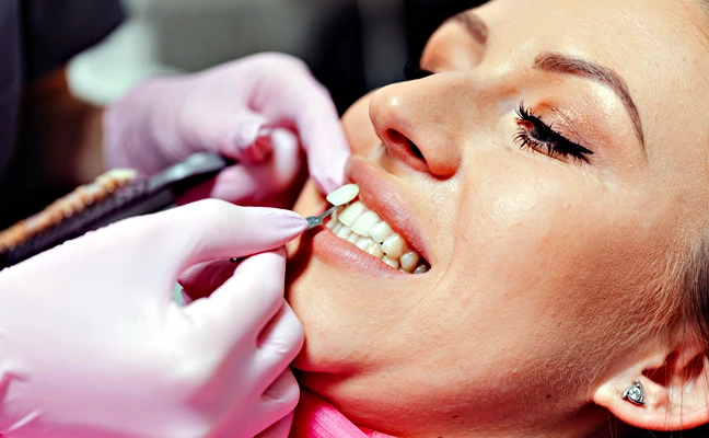 Dental Veneers in Grand Prairie