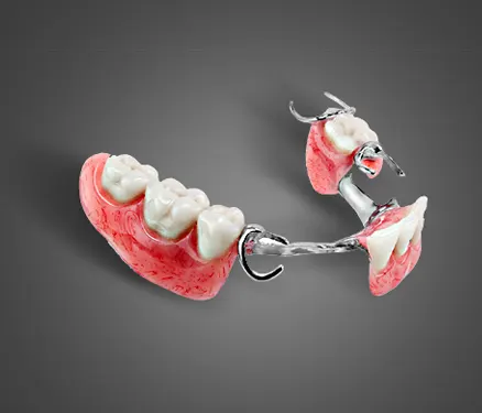 Affordable Implant Dentures